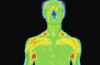 热成像仪中热通量传感器用于人体疼痛区分布检测
