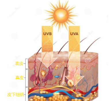 紫外线传感器用于检测皮肤紫外光疗中的紫外线强度